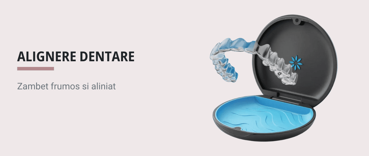 Descopera Secretul unui Zambet Perfect: Alignere Dentare - Articol ortodonție Cluj