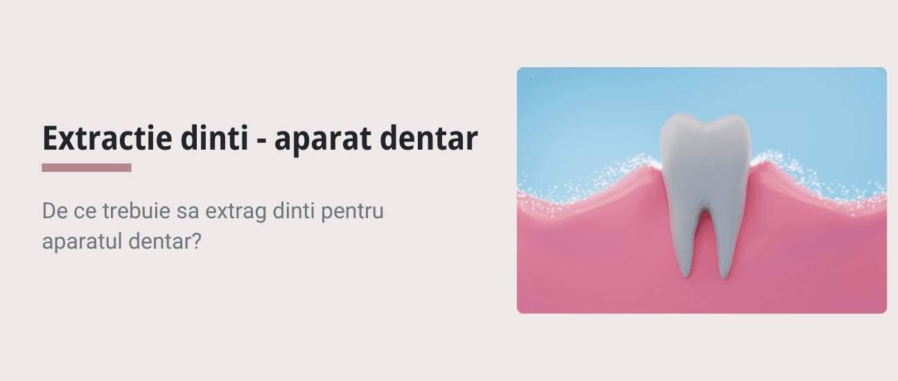 Extractia Dintilor pentru Aparatul Dentar: Ce Trebuie Sa Stii - Articol ortodonție Cluj