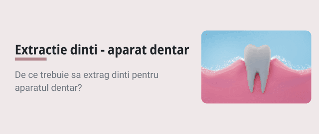 Extractia Dintilor pentru Aparatul Dentar: Ce Trebuie Sa Stii - Articol ortodonție Cluj