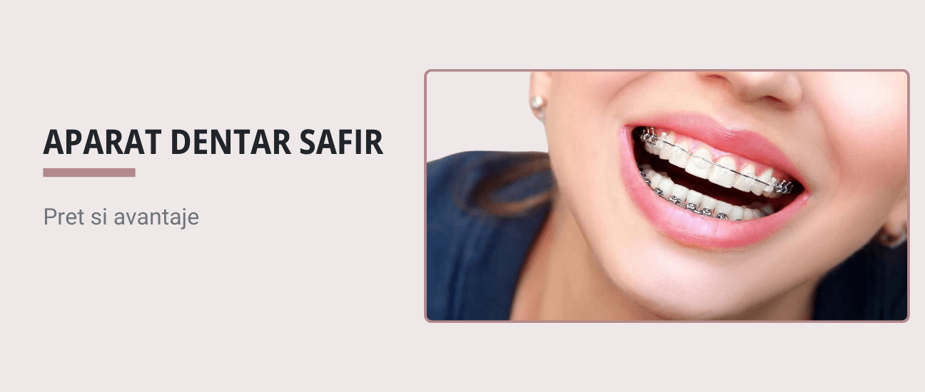 Aparat dentar safir - pret si avantaje - Articol ortodonție Cluj
