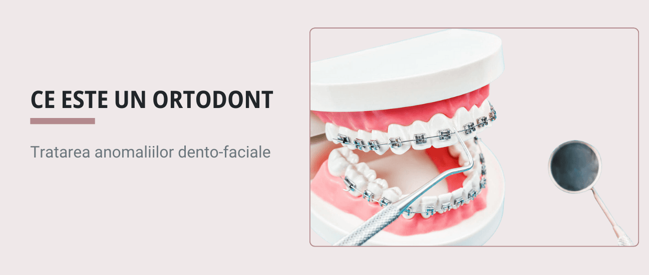 Ce este un ortodont? - Articol ortodonție Cluj