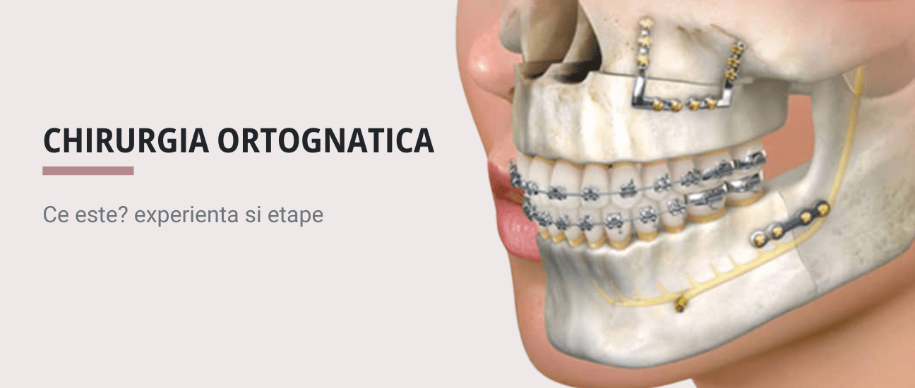 Chirurgia ortognatica Cluj-Napoca - Articol ortodonție Cluj