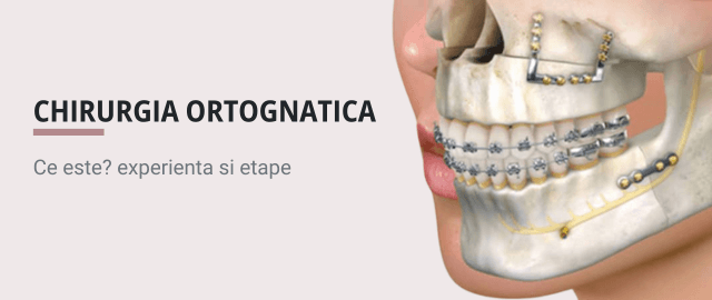 Chirurgia ortognatica Cluj-Napoca - Articol ortodonție Cluj