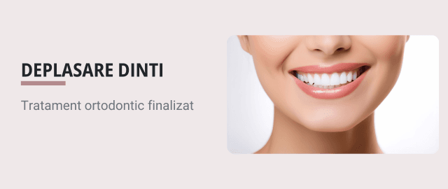 Ce cauzeaza deplasarea dintilor dupa tratamentul ortodontic (aparat dentar)? - Articol ortodonție Cluj