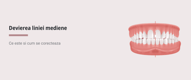 Devierea liniei mediene: cauze, simptome si corectare