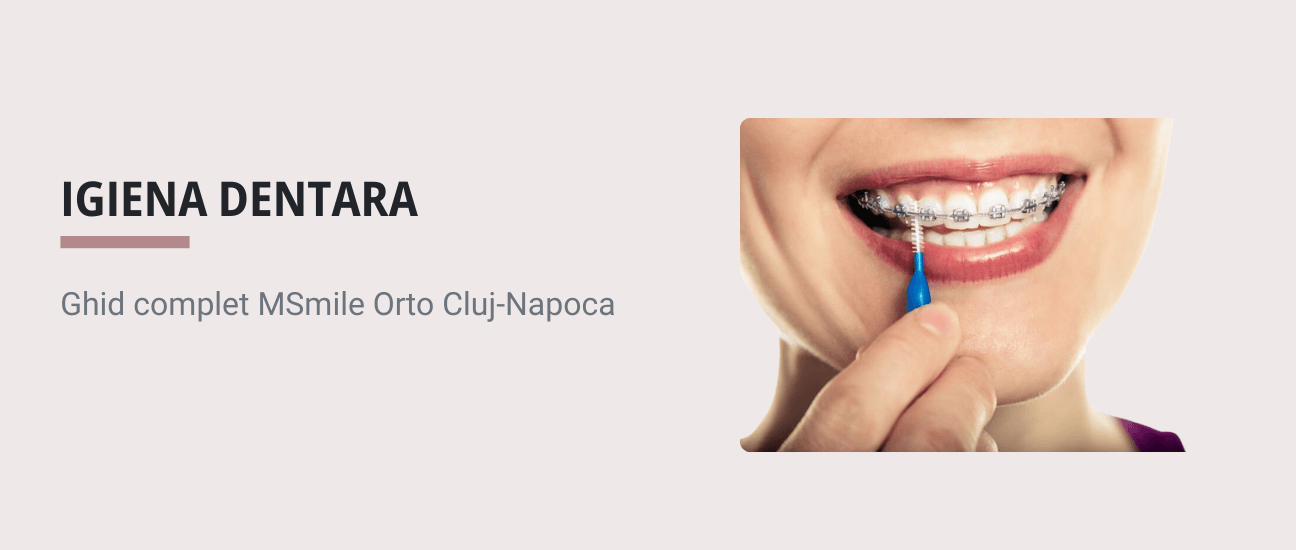 Igiena dentara cu aparat dentar cluj - Ghid complet MSmile Orto Cluj-Napoca - Articol ortodonție Cluj