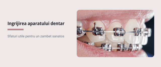 Ingrijirea aparatului dentar - Articol ortodonție Cluj