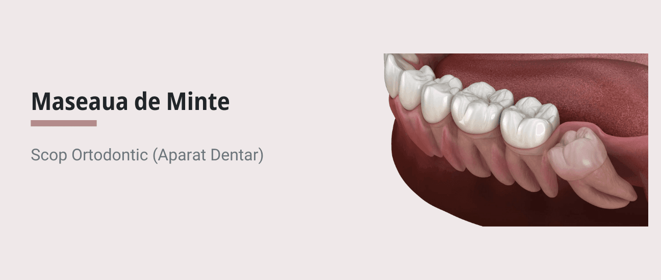 Măseaua de minte - când trebuie extrasă și cum influențează dinții - Articol stomatologie