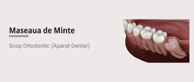Extractie Masea de Minte in Scop Ortodontic (Aparat Dentar) - Articol ortodonție Cluj