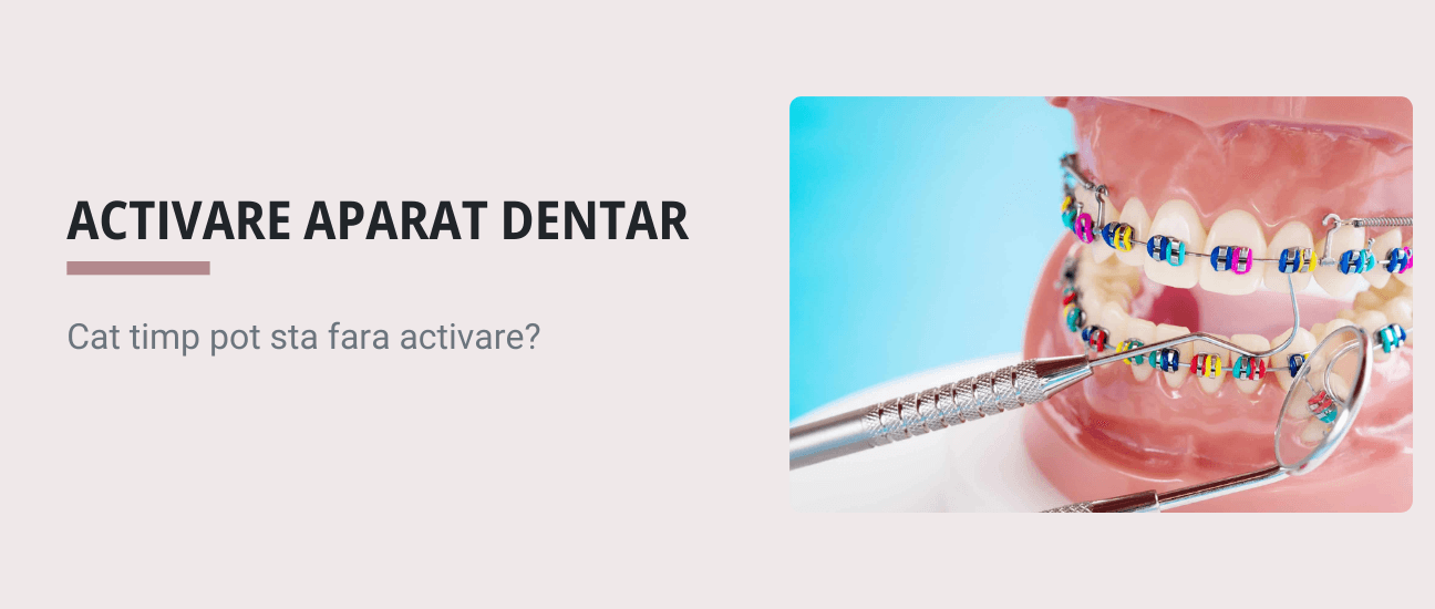 Cat timp poti sta fara sa iti activezi aparatul dentar? - Articol ortodonție Cluj