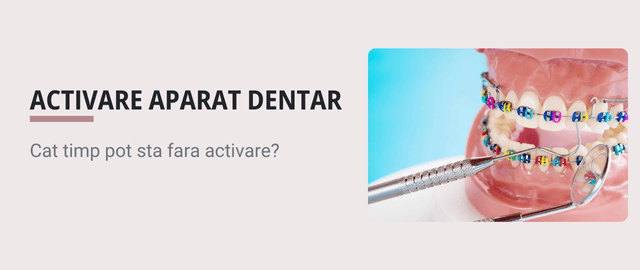 Cat timp poti sta fara sa iti activezi aparatul dentar? - Articol ortodonție Cluj