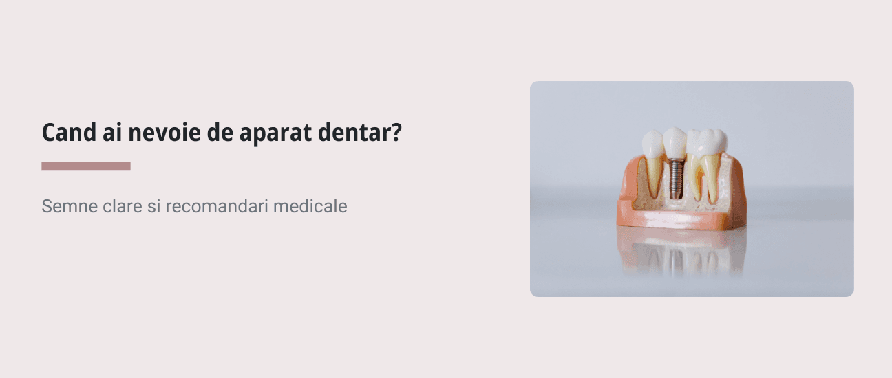 Cand e momentul sa porti aparat dentar? - Articol ortodonție Cluj