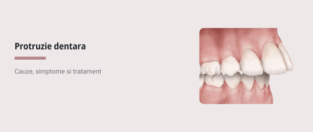 Protruzie dentara: cauze, simptome si tratament