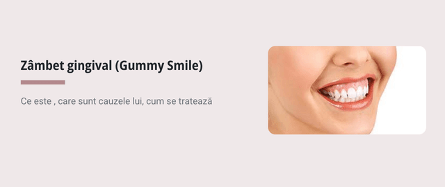 Zâmbet gingival (Gummy Smile): cauze și tratament - Articol stomatologie
