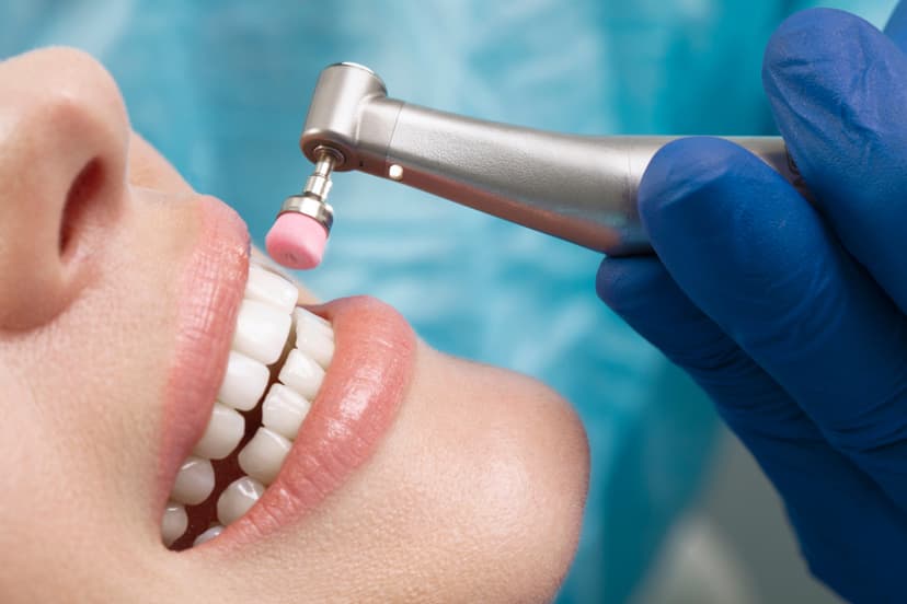 Periaj dentar profesional