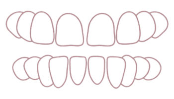 Spatiere dentara