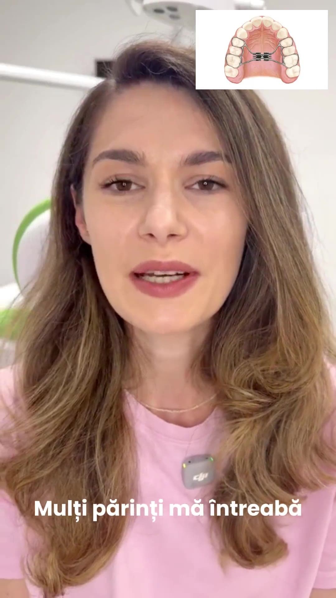 Disjunctorul dentar la copii - Ghid pentru părinți Dr. Larisa Moldovan-Monea