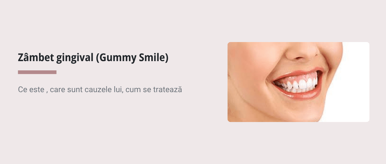 Zâmbet gingival (Gummy Smile): cauze și tratament ortodontic - Articol stomatologie