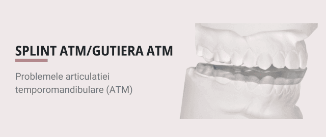 Ce este un Splint ATM si cand am nevoie de un Splint ATM.